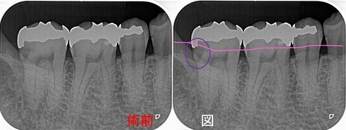 2022年3月アーカイブ - EE DENTAL_Blog